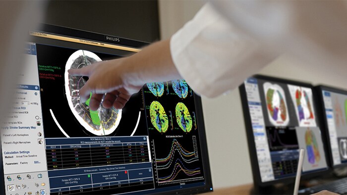 Close up of a doctor using touchscreen that portrays patient scans