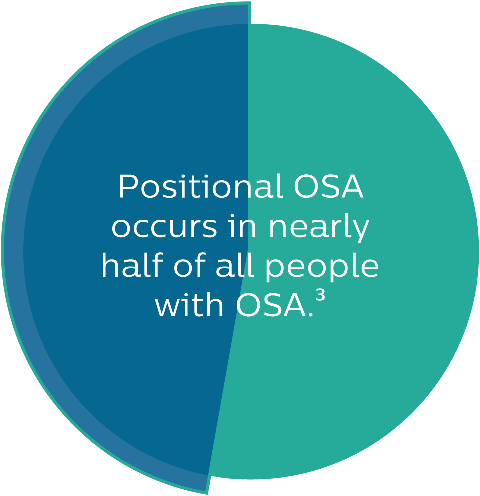 Positional OSA is more common than you might realize