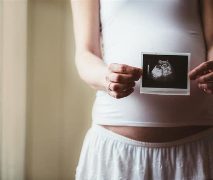 Pregnant women holding an ultrasound image