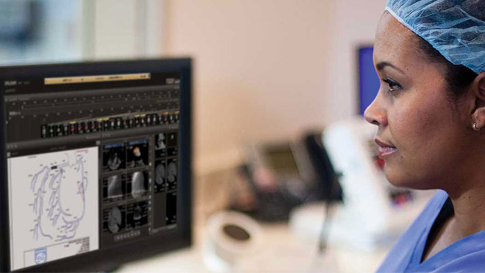 Cardiology Informatics | Philips Healthcare
