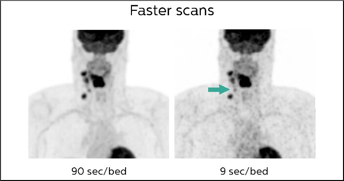 Faster Scans (opens in a new window) download image