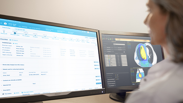 Streamline oncology workflows | Philips Healthcare