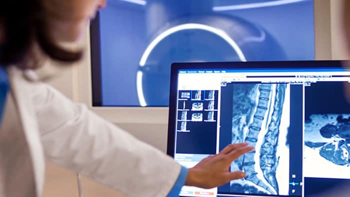 MR Ingenia Ambition 1.5T | Philips Healthcare