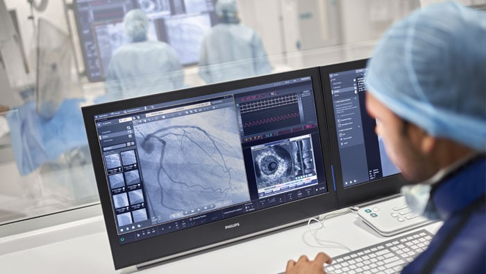 Percutaneous Coronary Intervention (PCI) | Philips