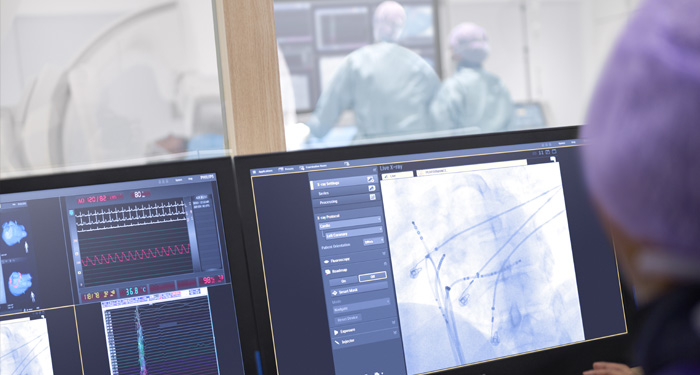 Optimize lab performance | Azurion | Philips Healthcare