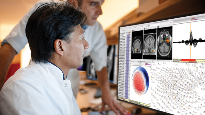 High Density EEG | Philips Healthcare