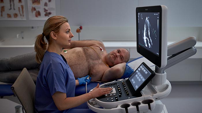 Affiniti CVx cardiovascular ultrasound system | Philips