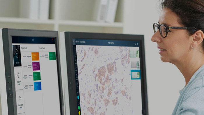 Philips Digital & Computational Pathology | Philips Healthcare