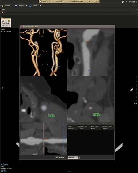 Connecting the radiologis to a patient's health journey