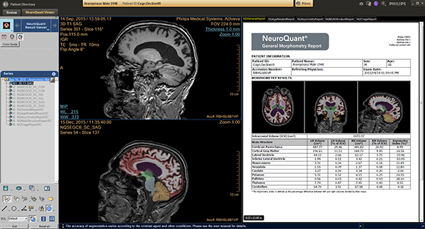 Connecting the radiologis to a patient's health journey
