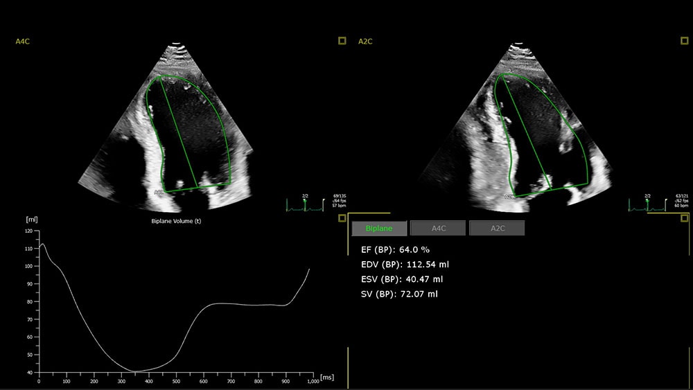 EPIQ CVx and CVxi with Auto EF