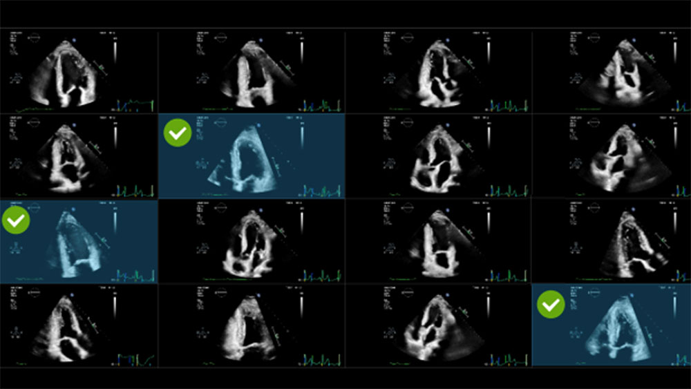 EPIQ CVx and CVxi with Smart View Select
