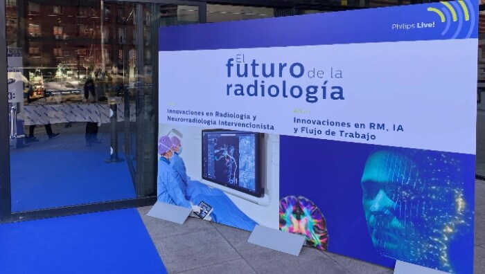 Philips presenta en Madrid sus nuevas soluciones para el diagnóstico y ...