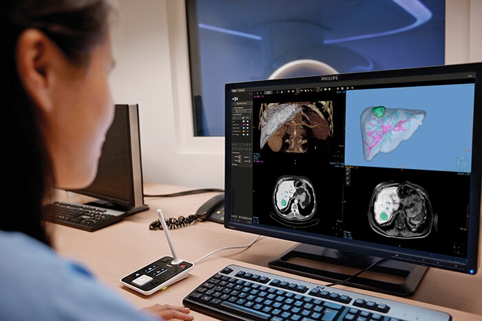 Philips IntelliSpace Oncology – The Philips IntelliSpace Oncology is a cloud-based oncology solution which offers stakeholders along the patient journey is seamless data integration across specialties and locations