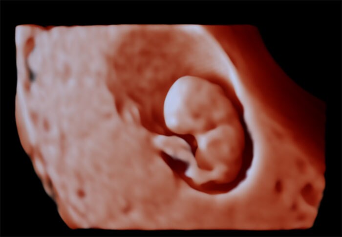 8 week fetus truevue