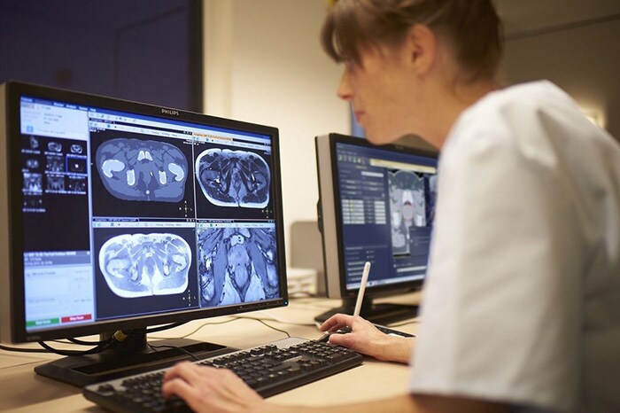 How can AI help radiologists perform higher-level tasks