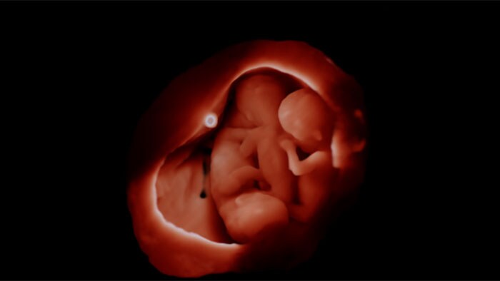 How photorealistic ultrasound images are changing the way parents bond with their children before birth
