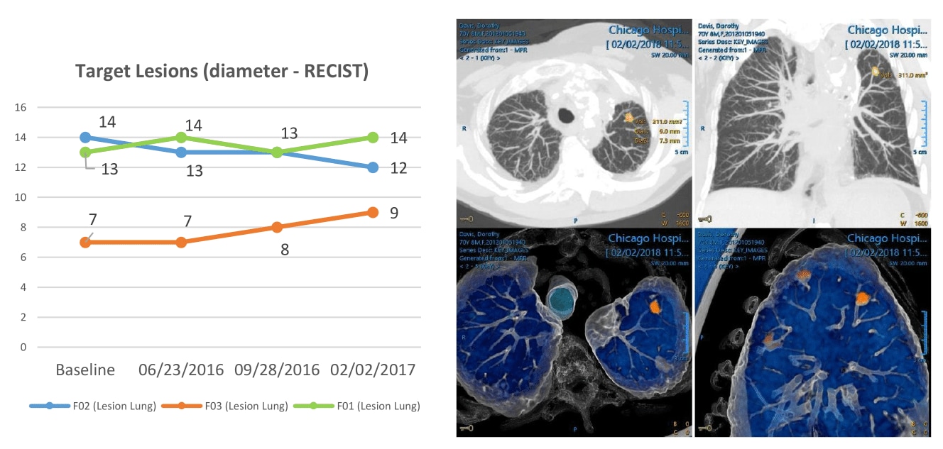 Radiology reporting