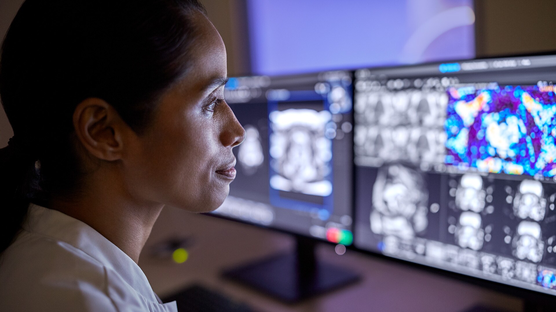 Reclaiming time in radiology: how AI can help tackle staffing and care gaps by streamlining workflows
