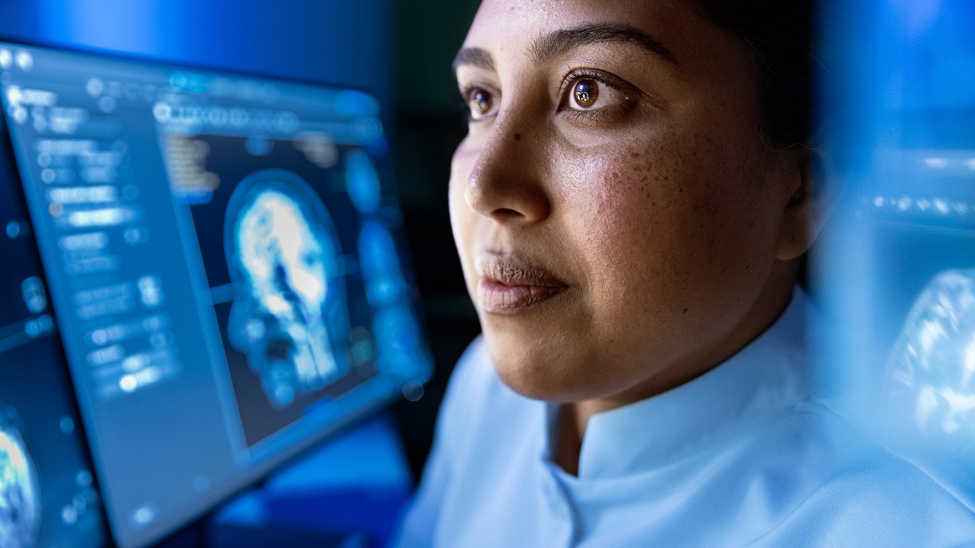 AI in radiology: three keys to real-world impact