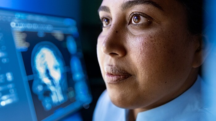 AI in radiology: three keys to real-world impact