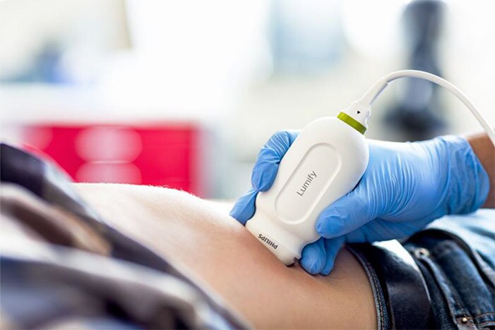 philips ultrasound 