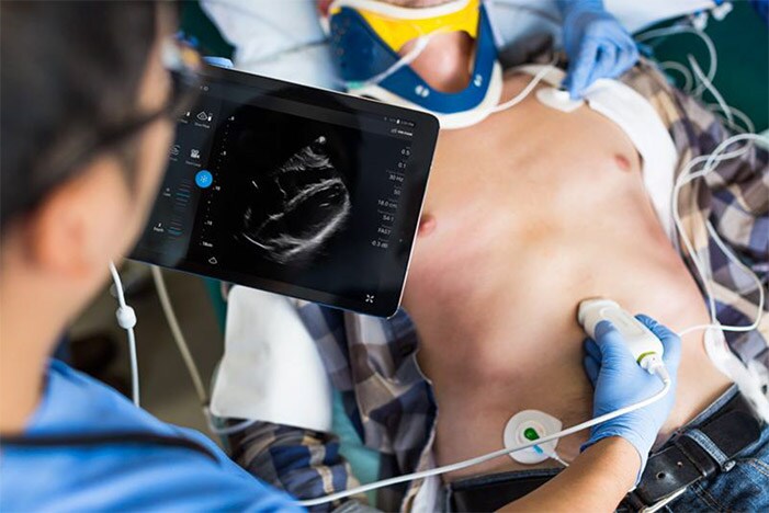 philips ultrasound 