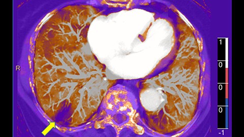 L'UCL Saint-Luc de Bruxelles à la pointe en imagerie médicale avec le ...