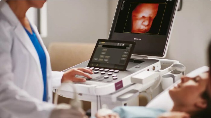 Uncompromised imaging, features and workflow in a premium compact ultrasound system