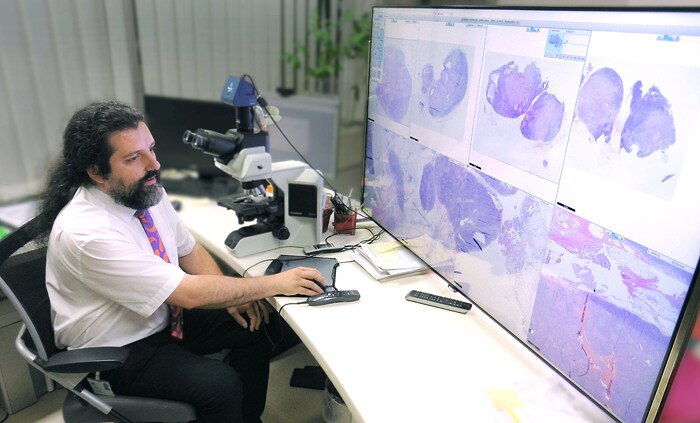 dr afschin soleiman use a inch k tv screen with philips digital pathology 