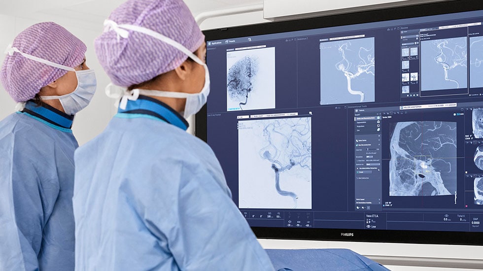 Azurion SmartCT neuro
