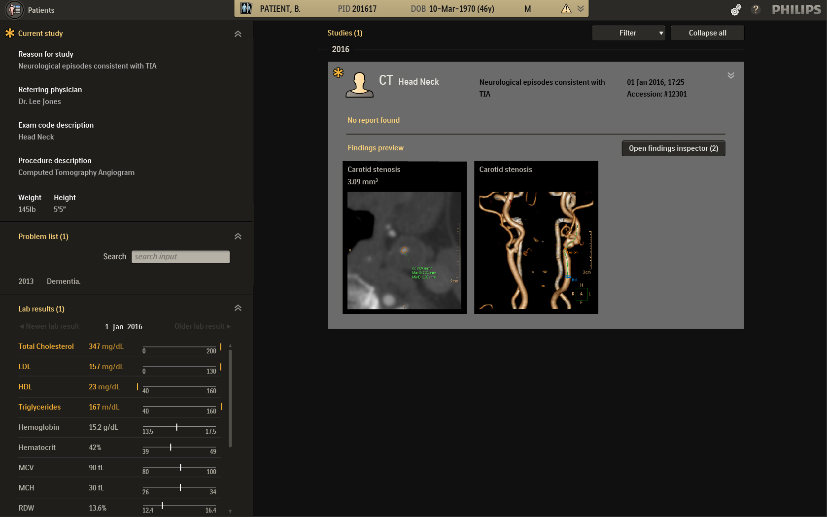 Imaging Approaches Expand View Into >> Philips Is First To Bring Adaptive Intelligence To Radiology Imaging Approaches Expand View Into >> Philips Is First To Bring Adaptive Intelligence To Radiology