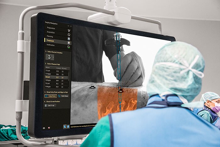 Download image (.jpg) Philips Hybrid Operating Room with Surgical Navigation Technology (opens in a new window)