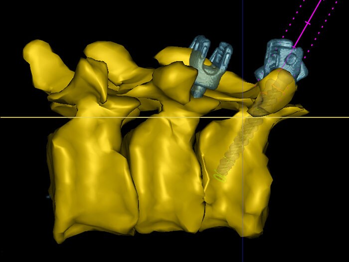 Download image (.jpg) Philips Hybrid Operating Room with Surgical Navigation Technology (opens in a new window)