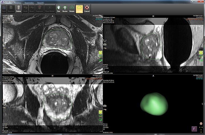 Download image (.jpg) IntelliSpace Portal 10 supports Philips expansion into DynaCAD Prostate solutions (opens in a new window)