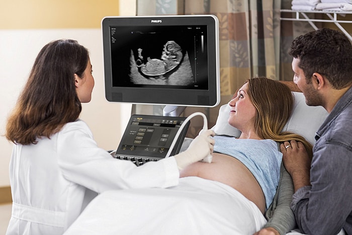 Download image (.jpg) Through advanced PureWave crystal technology, the eL18 4 ultrasound transducer provides exceptional 2D detail resolution combined with the penetration needed for diagnostic confidence in early obstetrical exams (opens in a new window)