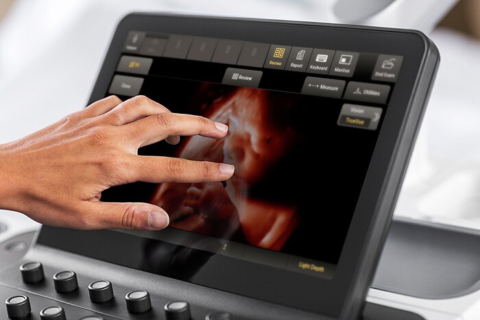 Download image (.jpg) Philips TouchVue is an easy, more intuitive method of 3D ultrasound image volume manipulation (opens in a new window)