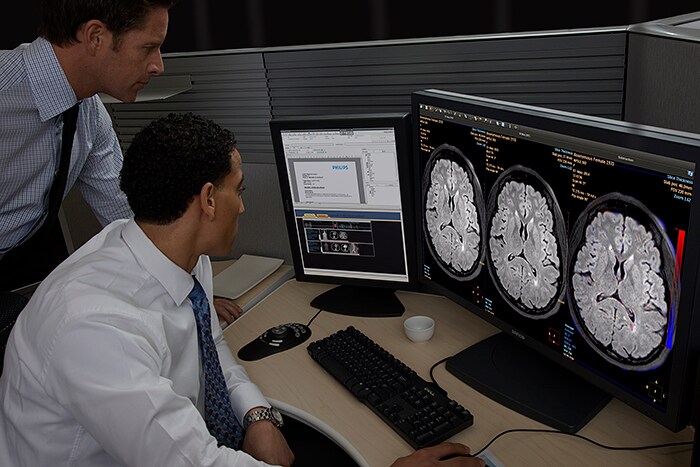 Download image (.jpg) IntelliSpace Portal offers Longitudinal Brain Imaging (LoBI), an application that has been optimized for the interpretation of brain MRI scan and aims to facilitate the longitudinal evaluation of neurological disorders helping clinicians to monitor disease progression.  (opens in a new window)