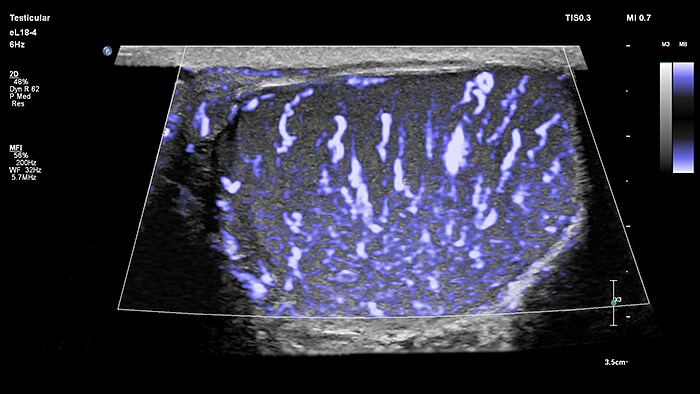 Download image (.jpg) Testicular ultrasound is one application of small parts imaging, a rapidly growing segment of ultrasound assessment, which allows clinicians to carefully examine organs close to the skin. (opens in a new window)