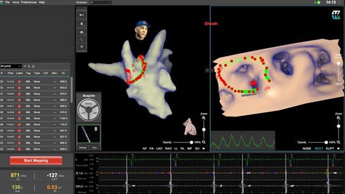 Download image (.jpg) EPD imaging and navigation system for EP (opens in a new window)