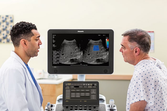 Download image (.jpg) Philips EPIQ premium ultrasound system (opens in a new window)