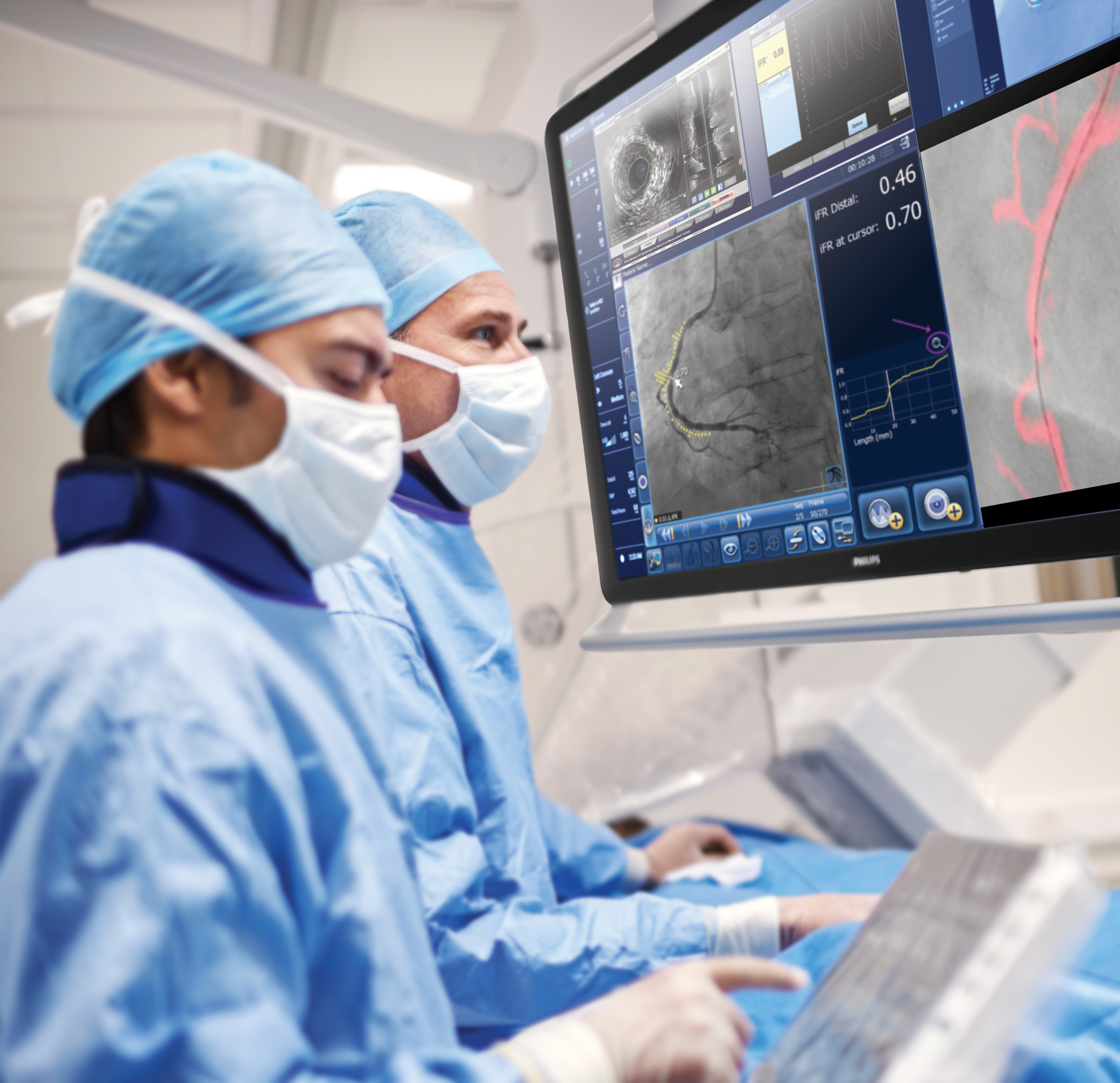 ESC incorporates iFR technology into updated guidelines News Philips