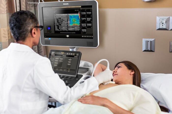 Download image (.jpg) A clinician carries out a patient exam with the Philips ultimate ultrasound solution for breast assessment (opens in a new window)