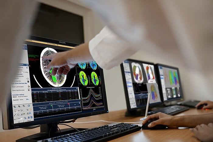 Download image (.jpg) IntelliSpace Portal 9 Advancing care Neurology (opens in a new window)