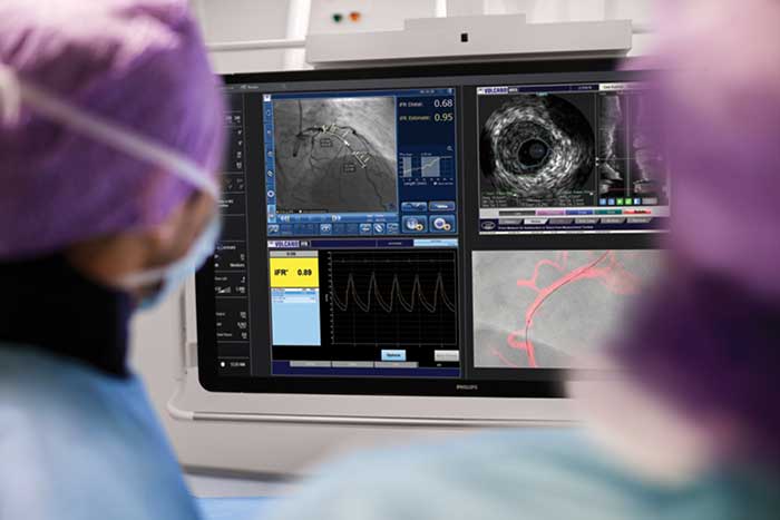 Download image (.jpg) Intravascular ultrasound (IVUS) (opens in a new window)