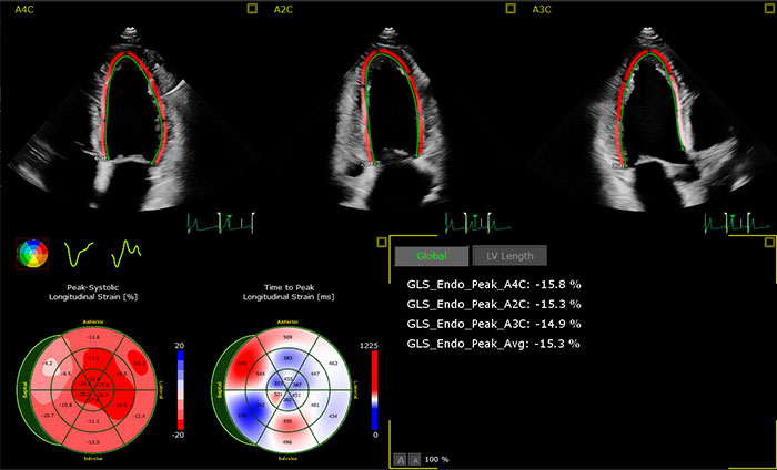 Download image (.jpg) Image showing the AutoStrain LV application (opens in a new window)