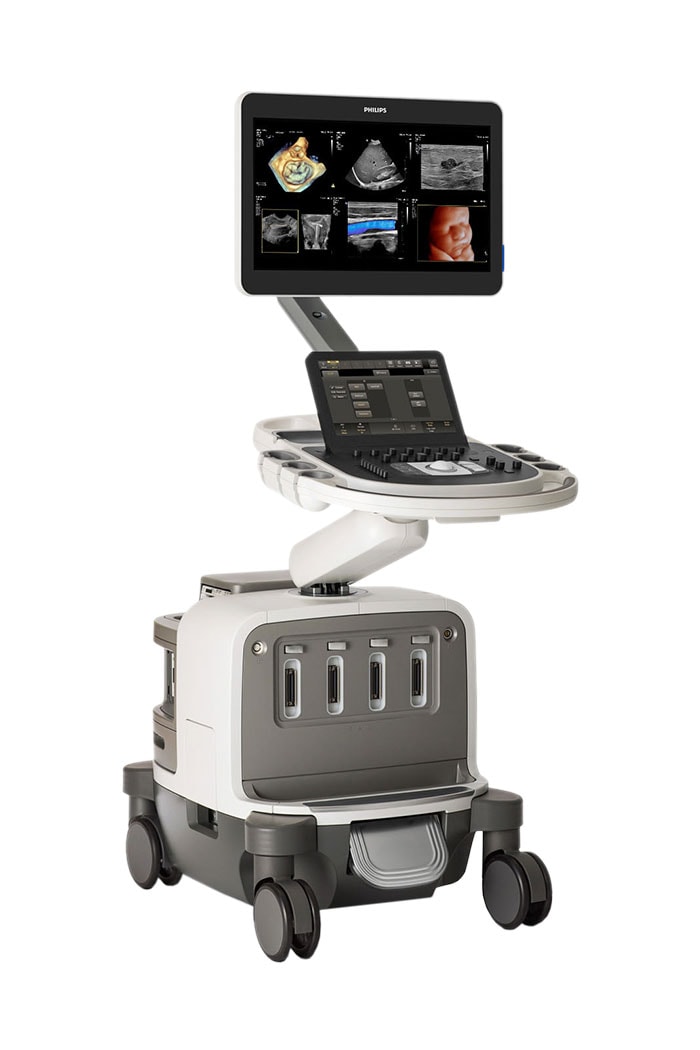 Download image (.jpg) Philips EPIQ Elite ultrasound system (opens in a new window)