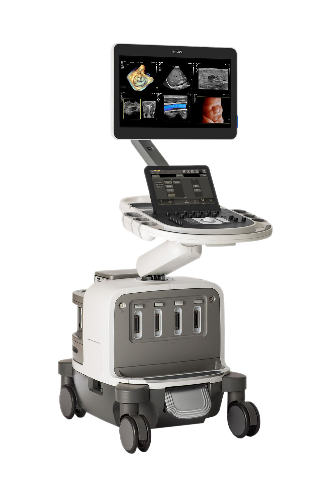  phillips epiq elite ultrasound 