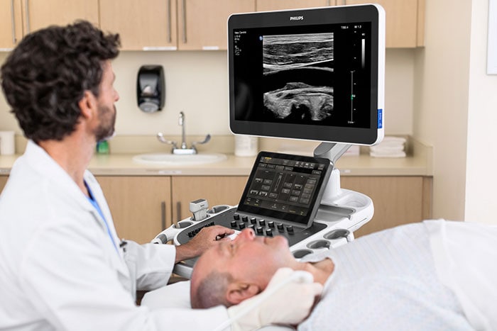 Download image (.jpg) Philips Ultimate Solution for Vascular Assessment (opens in a new window)
