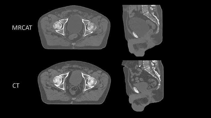 MRCAT CT clinical image comparison
